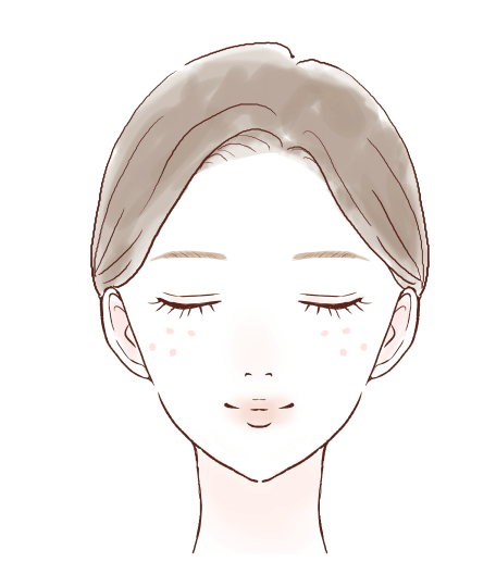 ニキビイラスト